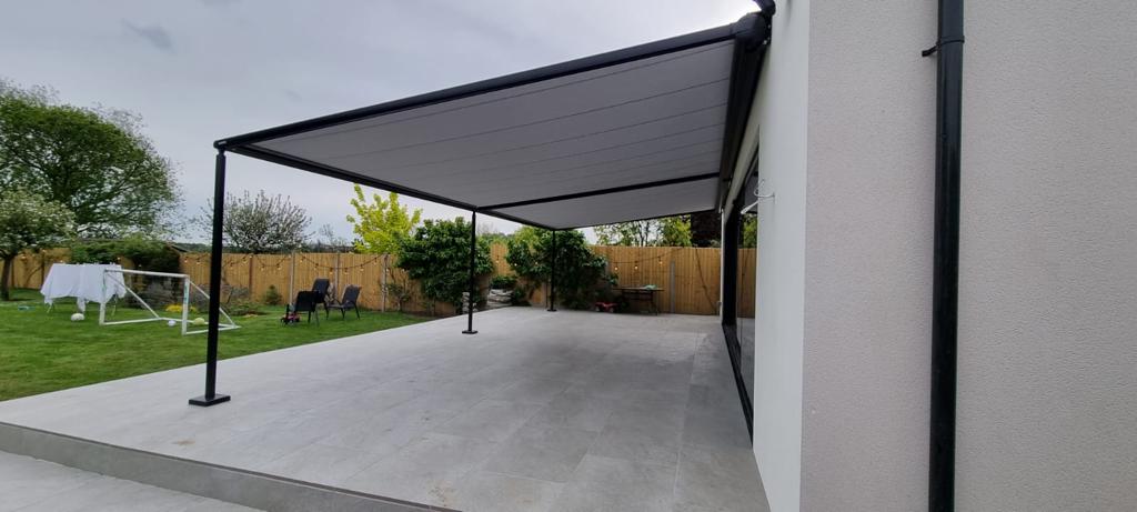 Awnings can be retractable